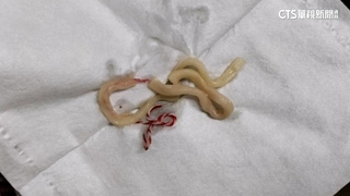 客控牛肉麵有棉線「被加料」　店家歉：疑麵粉袋掉落