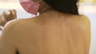 女逛榮星花園遭隨機毆打　動手婦：裙子太短！