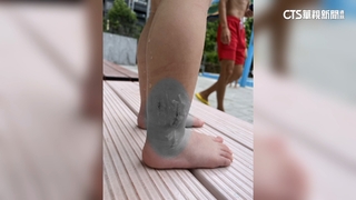 母控泳池水溝蓋破洞害童濺血　業者：協助理賠
