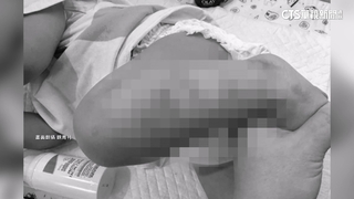 家長控「孩子被綁竹椅」涉虐　托嬰中心坦承疏失