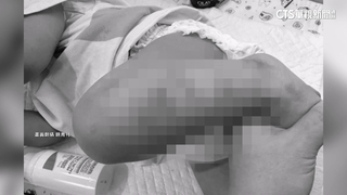 家長控師「將孩綁竹椅」涉虐　托嬰中心坦承疏失