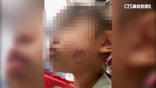 控幼園師不顧女兒挨打求救15次　園方：發現後有制止