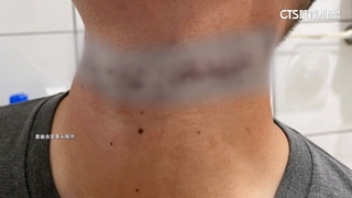 彷彿「絕命終結站」　機車騎士慘遭電纜線勒脖