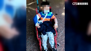 男童摔斷手「幼園稱監視器故障」　家長控隱匿