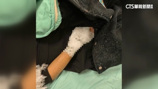 女在家衰遭友人債主開槍誤傷　送醫案情意外曝光