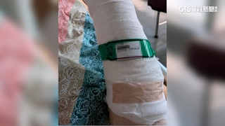 買早餐莫名被打斷手！鄰控動粗男常罵人　居民恐慌