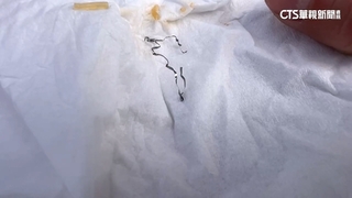 連鎖自助餐店吃到鋼絲險噎喉　店長致歉：加強教育