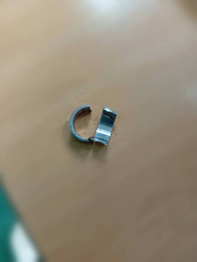 大馬少年「戒指套下體」慘卡住　消防員：鐵剪差點壞掉　　 | 華視新聞