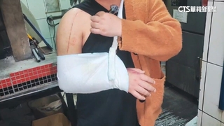 黑狗暴衝害摔　PIZZA店老闆骨折　無法營業損近90萬