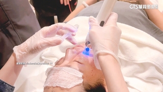 價差大！「外泌體」如細胞間郵差　具活化.促進再生修復功能