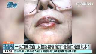 6千霧唇卻爛嘴！　女疑「藥膏害感染？」美容師駁指控