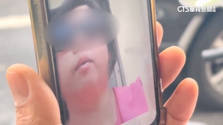 台失明女遭棄柬埔寨　與兄視訊落淚：好想回家