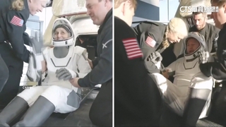 白髮蒼蒼.肌肉流失　滯太空9個月重返地球老10歲！