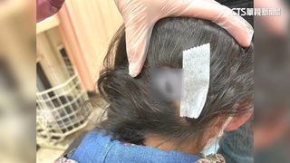 遊戲區6歲童「撞安全門」受傷　業者：檢視安全措施