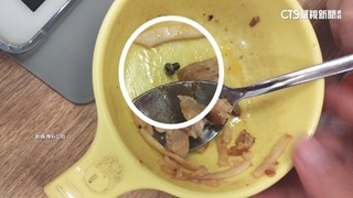 驚！　5歲童吃鐵板麵吐出「發黑螺絲」　衛生局：若違規開罰