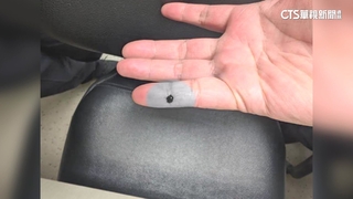 桃機針頭未依規定處理扎傷護理師　疾管署：了解原因中