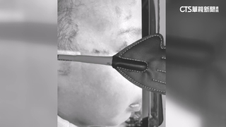 又傳虐童！　父控托育兒滿身傷　保母遭社會局撤照