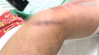 台南仁德休息站爆砍人事件！　國道刑警：非隨機攻擊