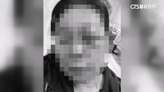 血跡斑斑！男病患洗牙喊痛　揮拳毆女牙醫後投案