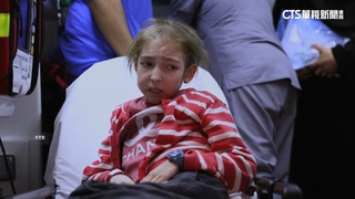 12歲巴女童營養不良　臉部浮腫嚴重脫髮