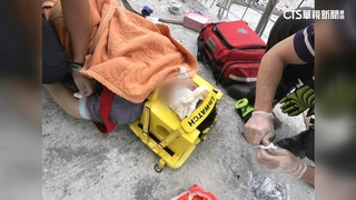 驚悚！　跌倒「鋼筋插入左眼」　34歲工人昏迷命危