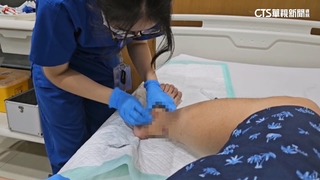 遊峇里島遭流浪狗咬傷！　旅客曝：治療費破18.5萬台幣