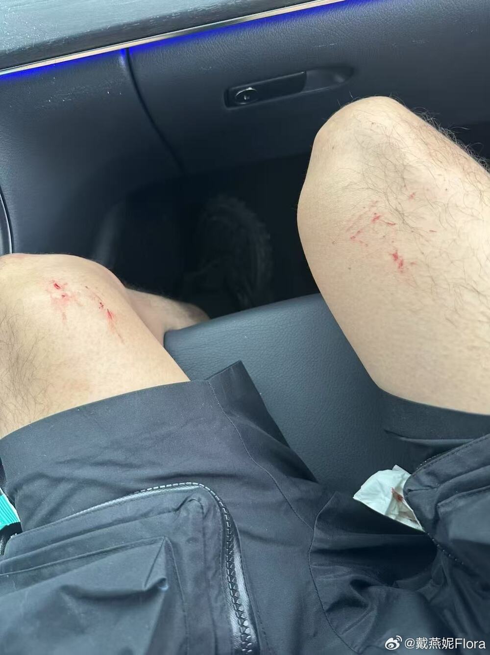 圖/翻攝自戴燕妮Flora微博