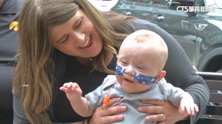 美國嬰兒「納許」早產133天　創金氏世界紀錄