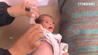 嬰兒手腳「瘦到如大人拇指」　加薩饑荒持續惡化
