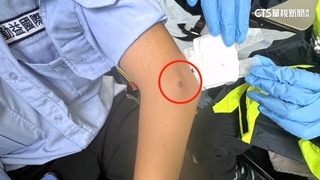 台中拖吊場遭人持空氣槍掃射　女保全手肘擦挫傷