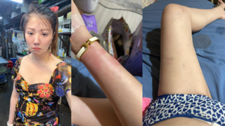 侯沁潔曬瘀傷照喊「遭霸凌」　委屈喊告員警：他賠不完