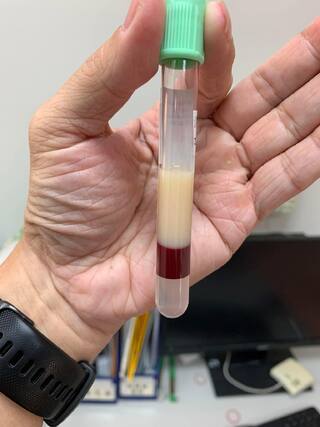 血「油油的」真的看得出來嗎？　陳志金曬1圖驚呆全網：默默放下手上食物