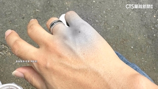 民眾黨走讀爆衝突遭送辦　陳智菡秀抓痕照反擊