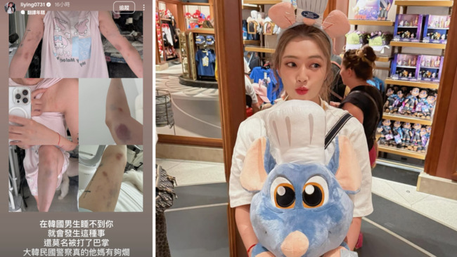 台YTR 在韓國「拒絕陪睡」遭暴打　瘀青照嚇壞網：歐巴的巴 是打巴掌的巴 | 華視新聞