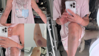 ​YouTuber劉力穎還原遭弘大韓男暴力過程　外交部：會提供必要協助