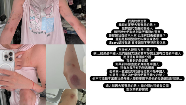 劉力穎在韓國遭毆打　男子身分曝光為「中國籍」　本人氣炸：在去警局的路上 | 華視新聞