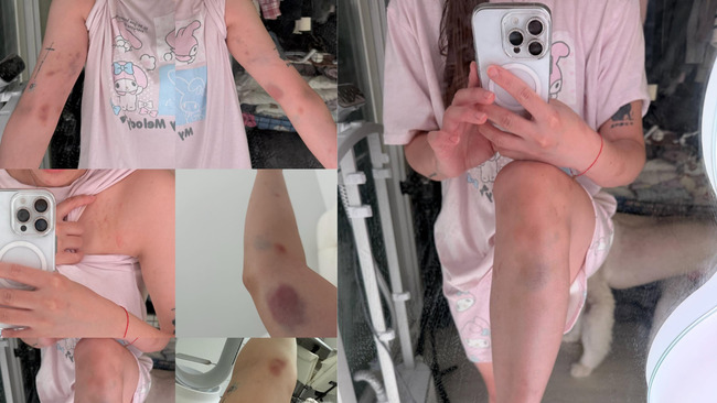 劉力穎在韓被毆打案反轉！　韓警「搞錯案」：施暴者不是中國籍 是韓國男子 | 華視新聞