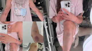 劉力穎在韓被毆打案反轉！　韓警「搞錯案」：施暴者不是中國籍 是韓國男子