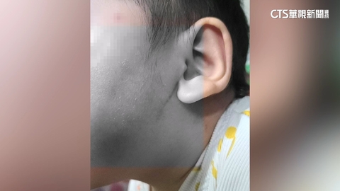 心碎!1個月凌虐逾20次害嬰腦出血 台南2保母遭羈押