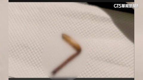 民眾疑吃到「蟑螂腳」　服務員：是蝦腳　飯店歉：送驗釐清