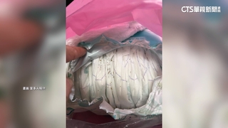 家長開箱新尿布驚見「爬滿螞蟻」　業者暫無回應