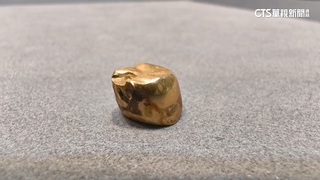 金價持續飆漲！　5旬男變賣「K金假牙」現賺3倍