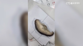 海產粥店家遭控香菇發霉　業者：香菇吸鮮蚵汁液印記