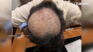 鄰被臭到「拔頭髮」解愁！　臭豆腐名店：將變更排放口位置