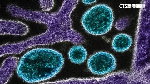 護理師染立百病毒逝　為印立百疫情首宗死亡病例