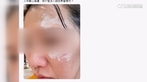 控餐廳清蒸魚爆炸燙傷臉無人聞問 業者:致電4次關心