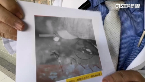 罕見！　伸手抱馬爾濟斯遭咬傷眼皮　小狗斷牙卡眼結膜