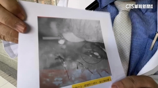 罕見！　伸手抱馬爾濟斯遭咬傷眼皮　小狗斷牙卡眼結膜