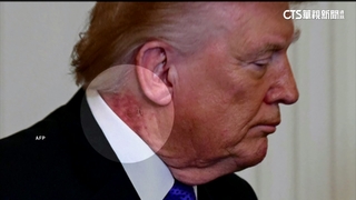 川普耳後脖子發紅　白宮醫師：擦藥膏產生現象