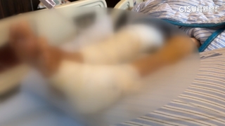 婦下田遭3犬攻擊「全身逾百處傷」　動防所：飼主可罰1.5萬元